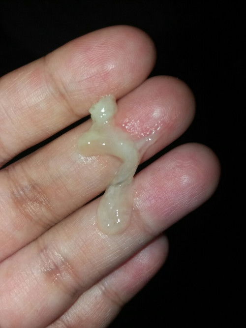 Keluar lendir seperti ingus saat hamil 39 minggu lebih 6 hari