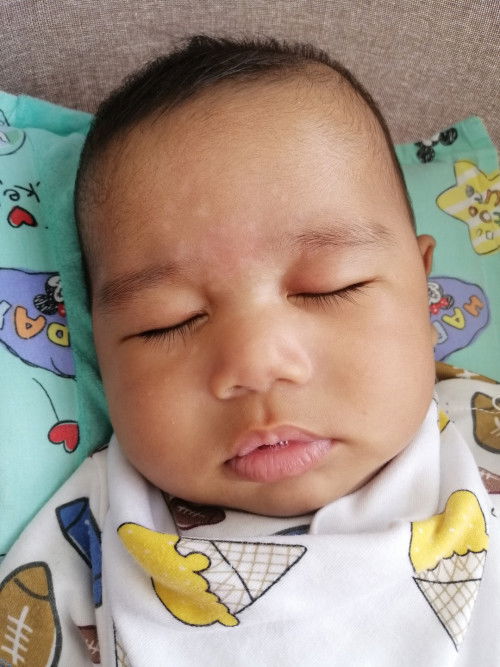 Tompok putih di muka baby