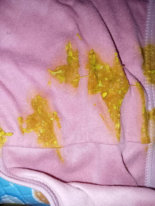 Tekstur fes*s bayi 2bulan