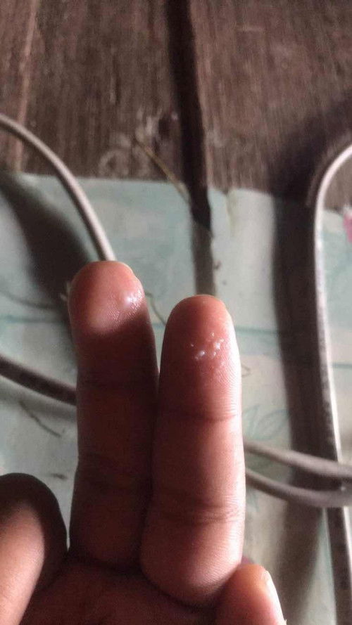 40+1ยังไม่คลอด