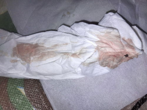 39 Week Keluar lendir + berdarah