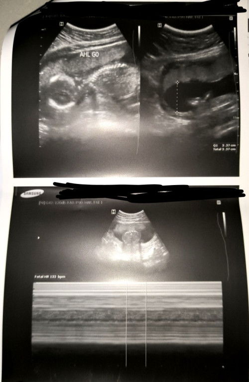 18w3d utz 🫶🏻🫶🏻🫶🏻