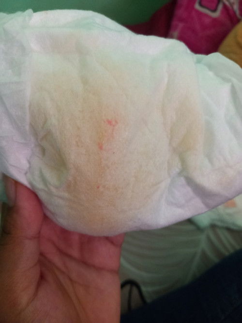 Adakah anak bunda disini yg mengalami sperti yg difoto?