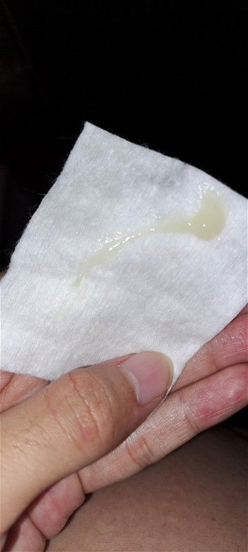 Keputihan di trimester 3