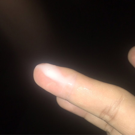 ตกขาวไม่มีกลิ่น ไม่คัน