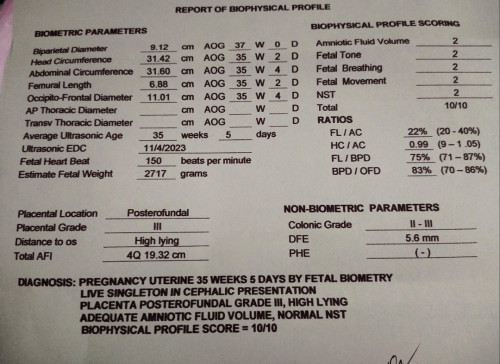 Bps/nst results
