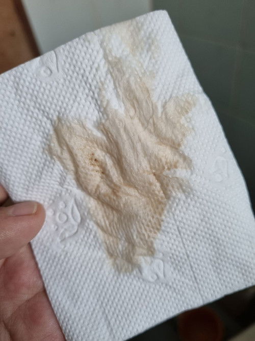 Discharge at 38 weeks