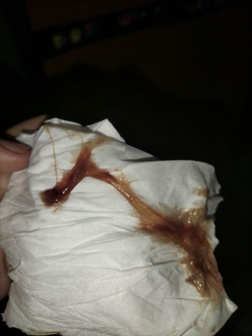 Apakah ini flek darah tanda lahiran atau bukan?