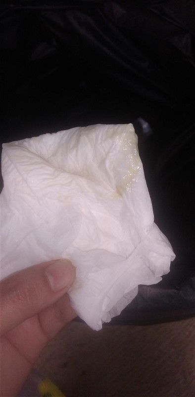 มีมูกใสออก