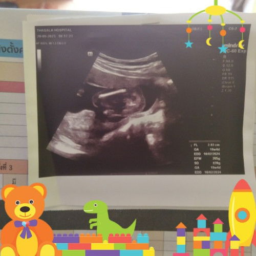 สัปดาห์ที่22