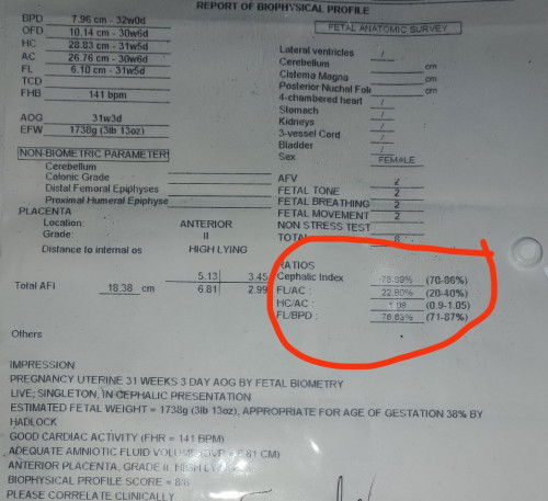 Normal po ba ang BPS RESULT ni baby?