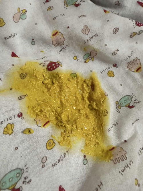 อึแบบนี้ปกติมั้ยคะ