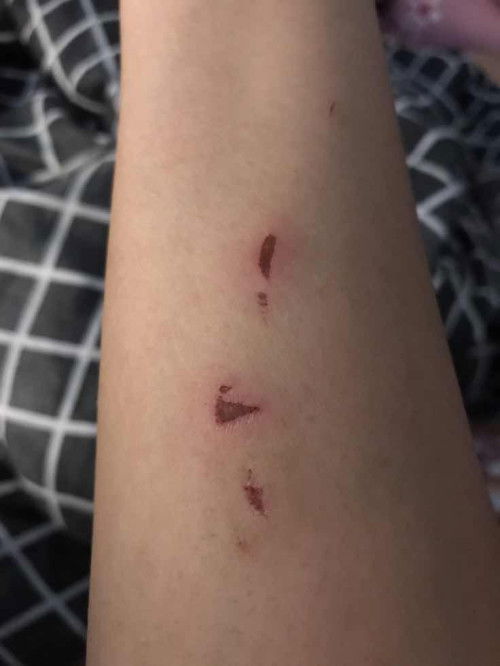 Suami sering main tangan ketika ribut