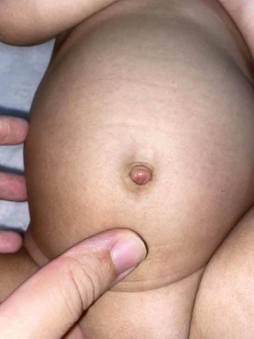 Hi semua, nak tanya pusat anak sy