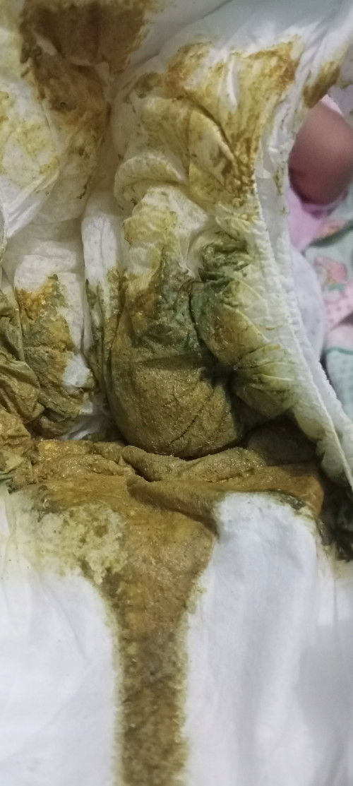 Bun saya mau nanyak bab ada saya seperti di gambar setelah makan bubur promina atau sun ituh normal