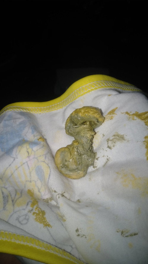 Pup bayi usia 1 bulan 15hari