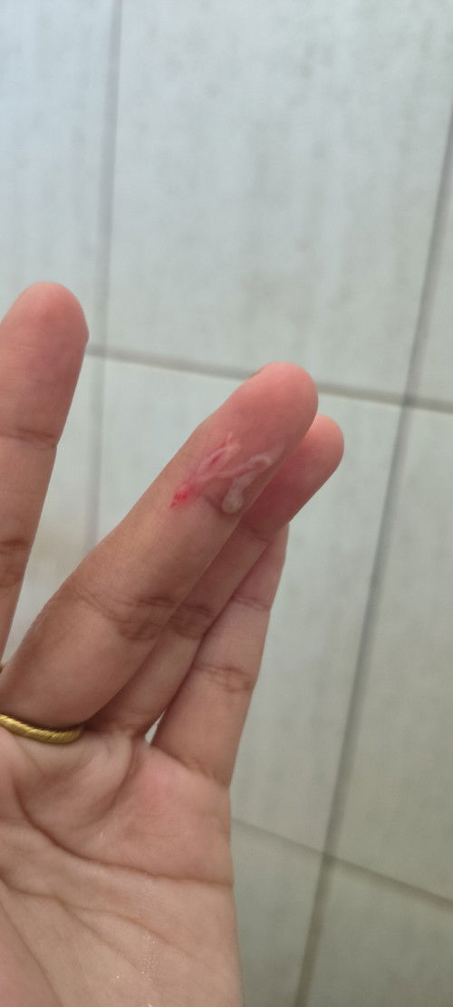 Hamil tidak berkembang