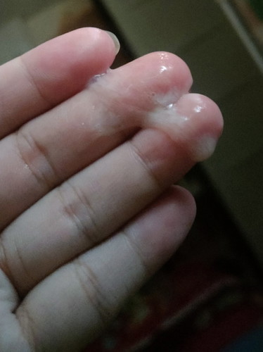 Mucus plug?
