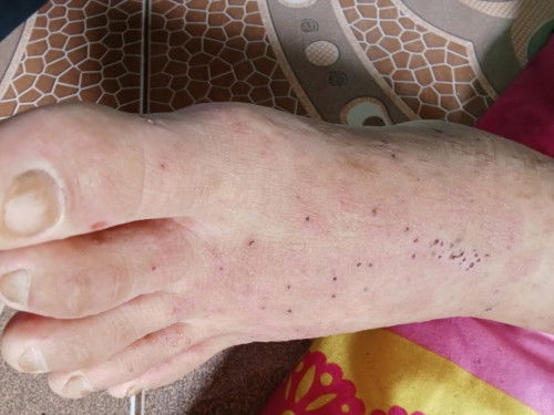 PUPPP apa ada yg sama ?