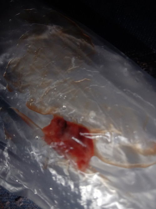 Keluar gumpalan darah