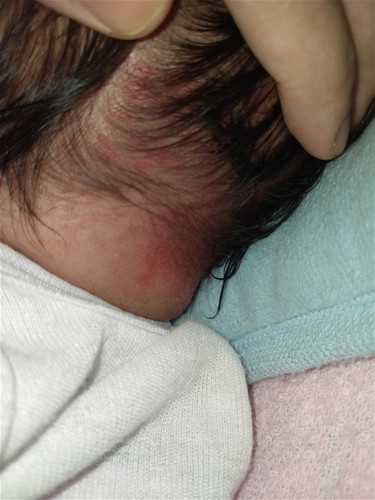 Bayi 1bulan