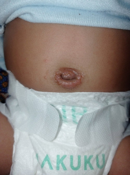 Pusar bayi 1 setengah bulan