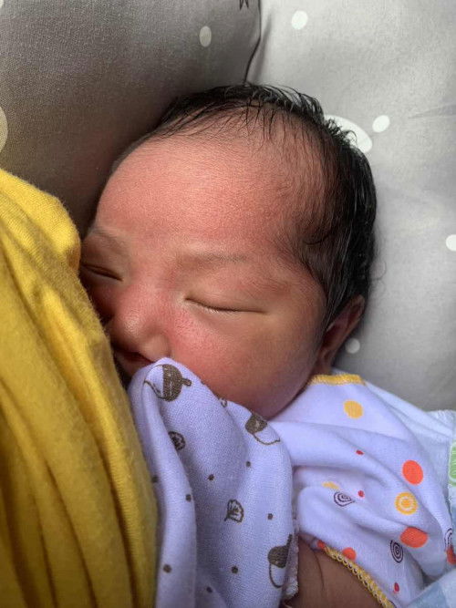 Bintik2 merah bayi NB