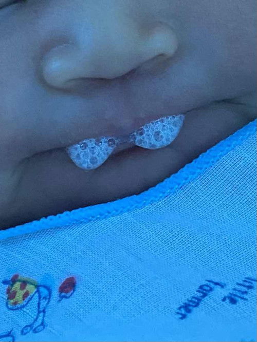 แบบนี้คือน้องเป็นไรคะ แหวะนม รึแค่เล่นน้ำลาย