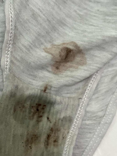 Bleeding / spotting