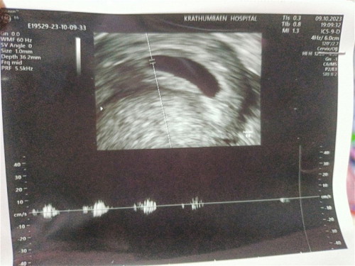 เจอตัวน้องแล้ว