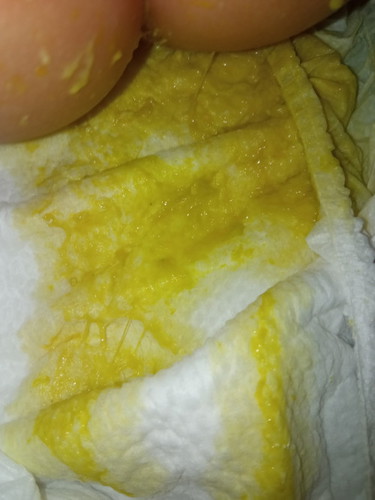 Urgent, sana po masagot 🙏🏻