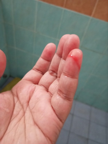 Lendir ap ni