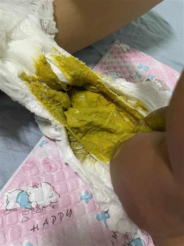 อึลูกเป็นแลบนี้ควรทำยังไงคะ