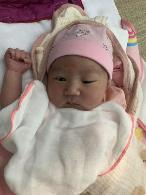 Mắt bé không đều nhau