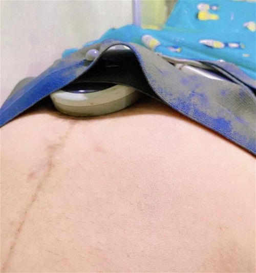 เจ็บเตือน 35 week = 8 เดือนกว่า