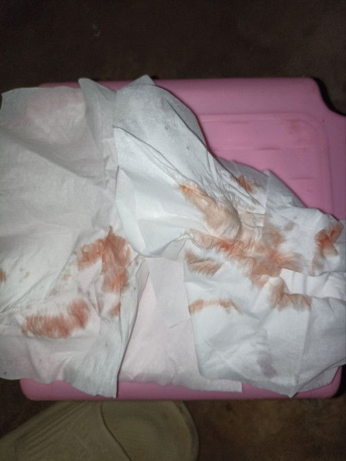 40+3มีเลือดออก