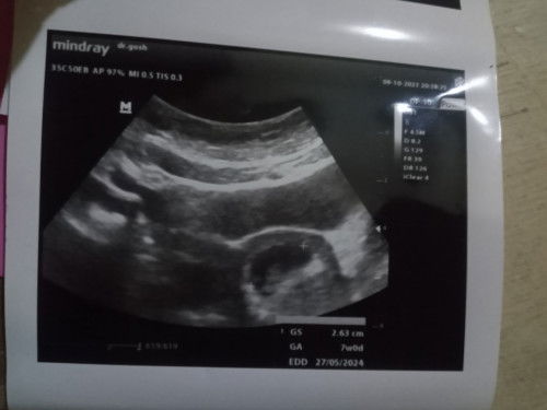 Sharing hasil Usg 7week