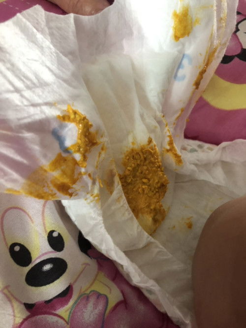 น้องอึแบบนี้ ปกติไหมคะ