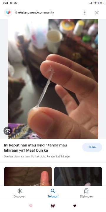 Hamil 34 Minggu keputihan biasa apa mau lahiran