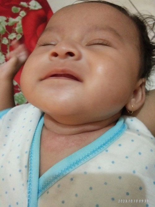 Bintik merah pada leher bayi