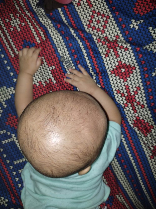 Kepala peyang