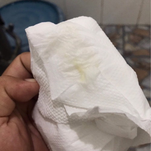 อายุครรภ์ 38+2 วีค
