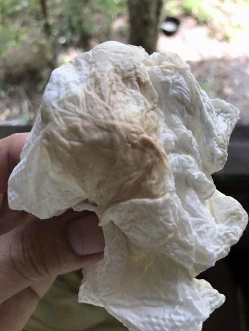 ขอคำแนะนำจากแม่ๆหน่อยค่ะอาการแบบนี้ควรไปพบหมอมั้ยค่ะ