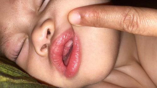 anak nak tumbuh gigi