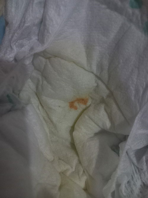 Bercak orange pada popok