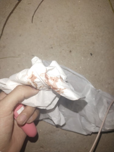 ขออภัยในความไม่สุภาพ แต่อยากรู้ส่านี่คือเลือดล้างหน้าเด็กหรือป่าว (ท้องแรก)