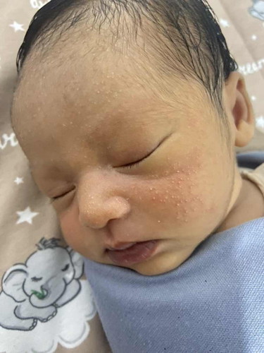 Newborn ku