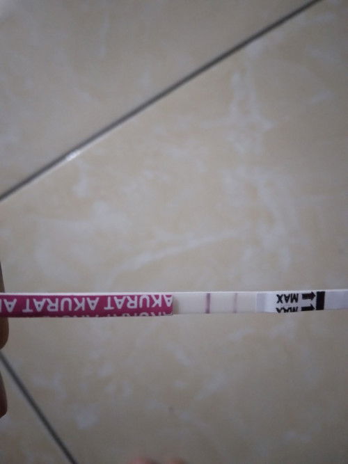 KET (Kehamilan Ektopik Terganggu)