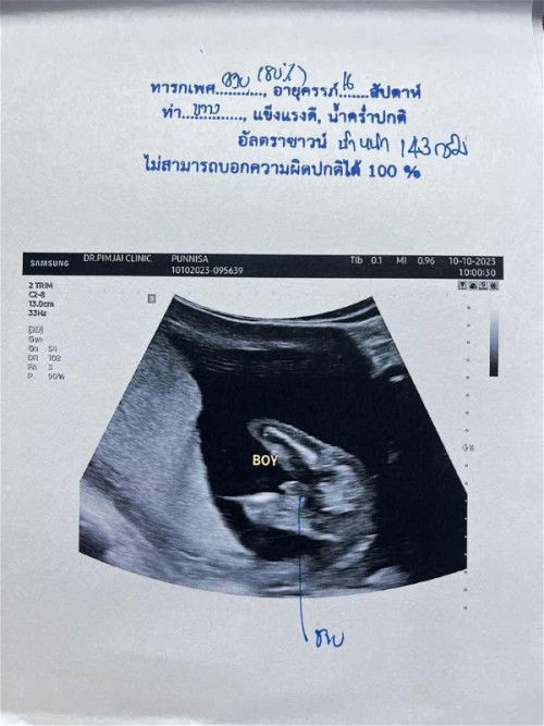 ทีม มีนาคม 2567