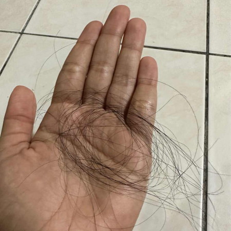 rambut gugur